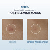 Lumiwise Brightening Emulsion 125ml