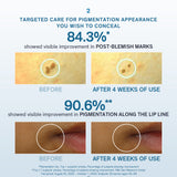 Lumiwise Discoloration Corrector 30ml